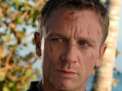 Daniel Craig poddaje się operacji plastycznej